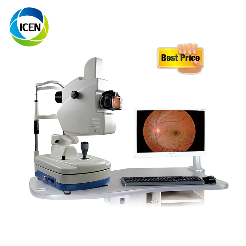in-Vder (Model A) New Auto Optical Digital Fundus Camera Price