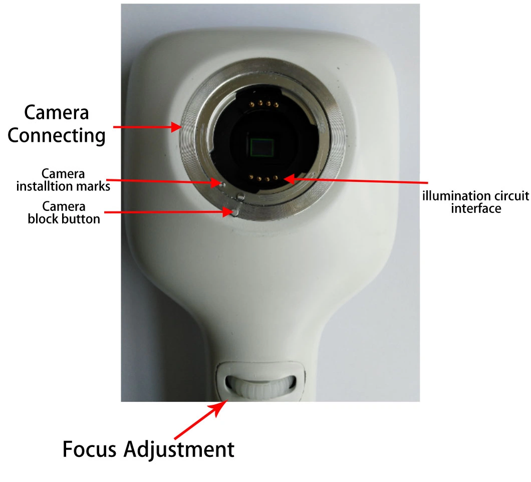 Hes-1000 Portable Handheld Non-Mydriatic Digital Fundus Retinal Camera