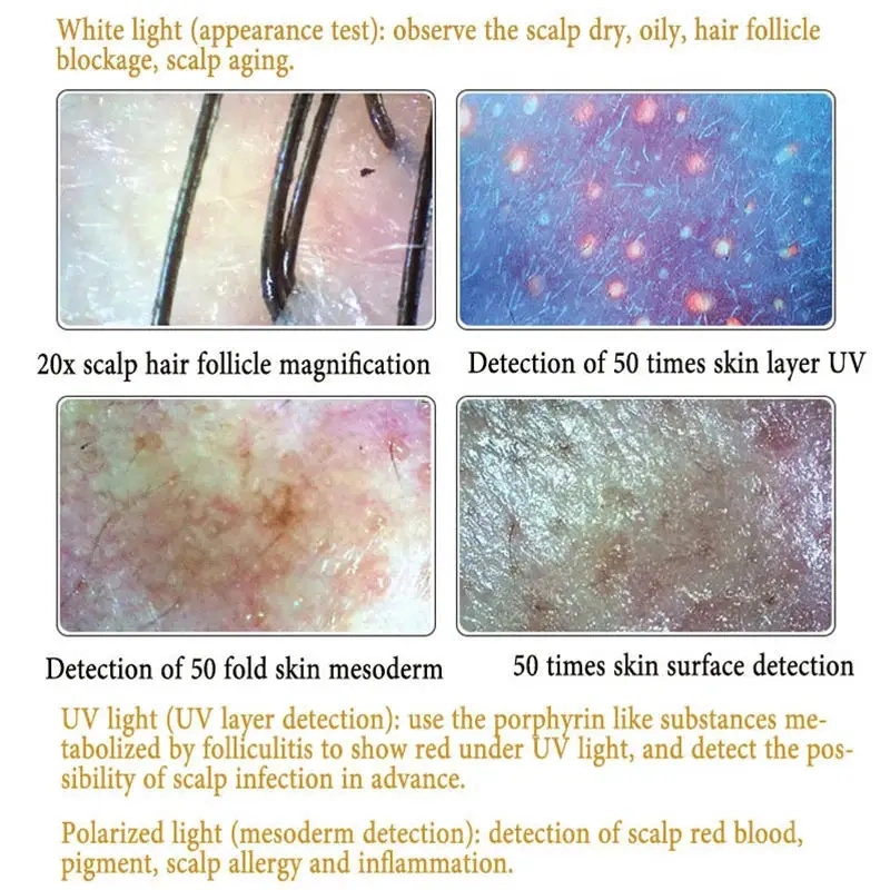 Wireless Mobile Software Face Scalp Hair Analysis Machine Four-Spectral Hair Analyzer UV Light Facial Skin Analyzer