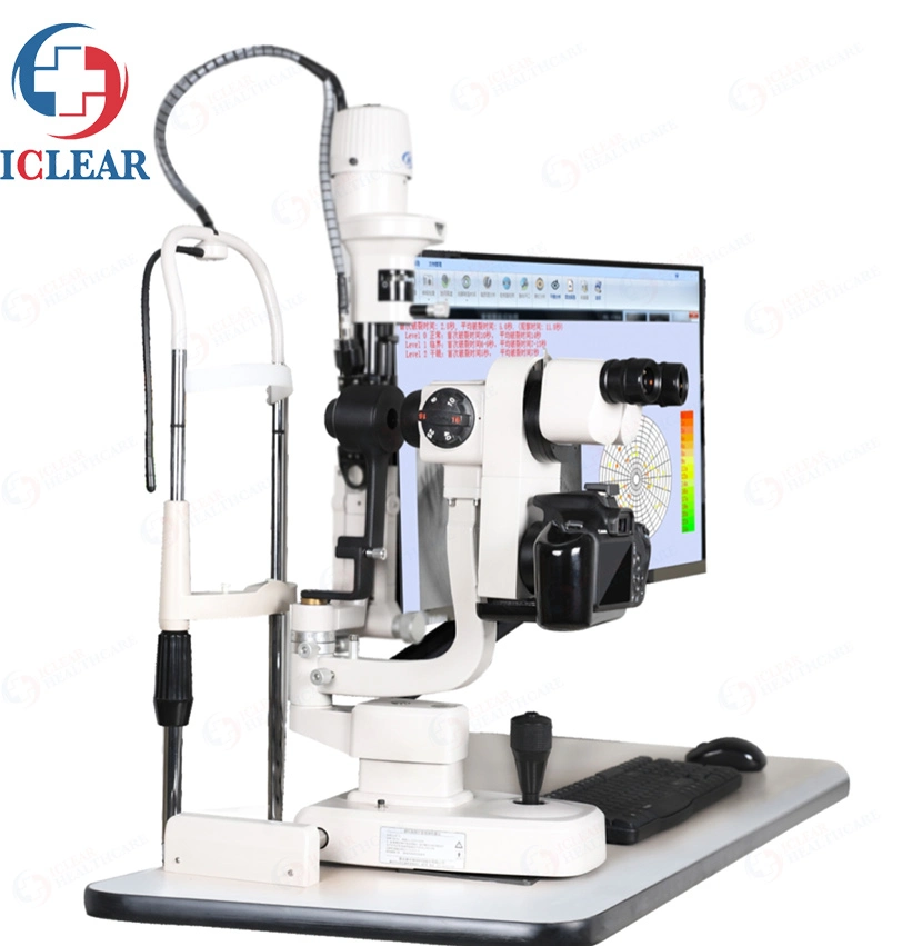 Ophthalmic Anterior Segment Dry Eye Examination Comprehensive Analyzer