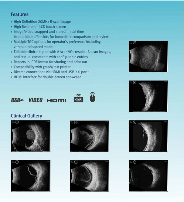 CE ISO Handheld Ophthalmic Ultrasound a/B Scan for Ophthalmological Ultrasonic Diagnosis and Al Biometric Measurement Mslmd23s
