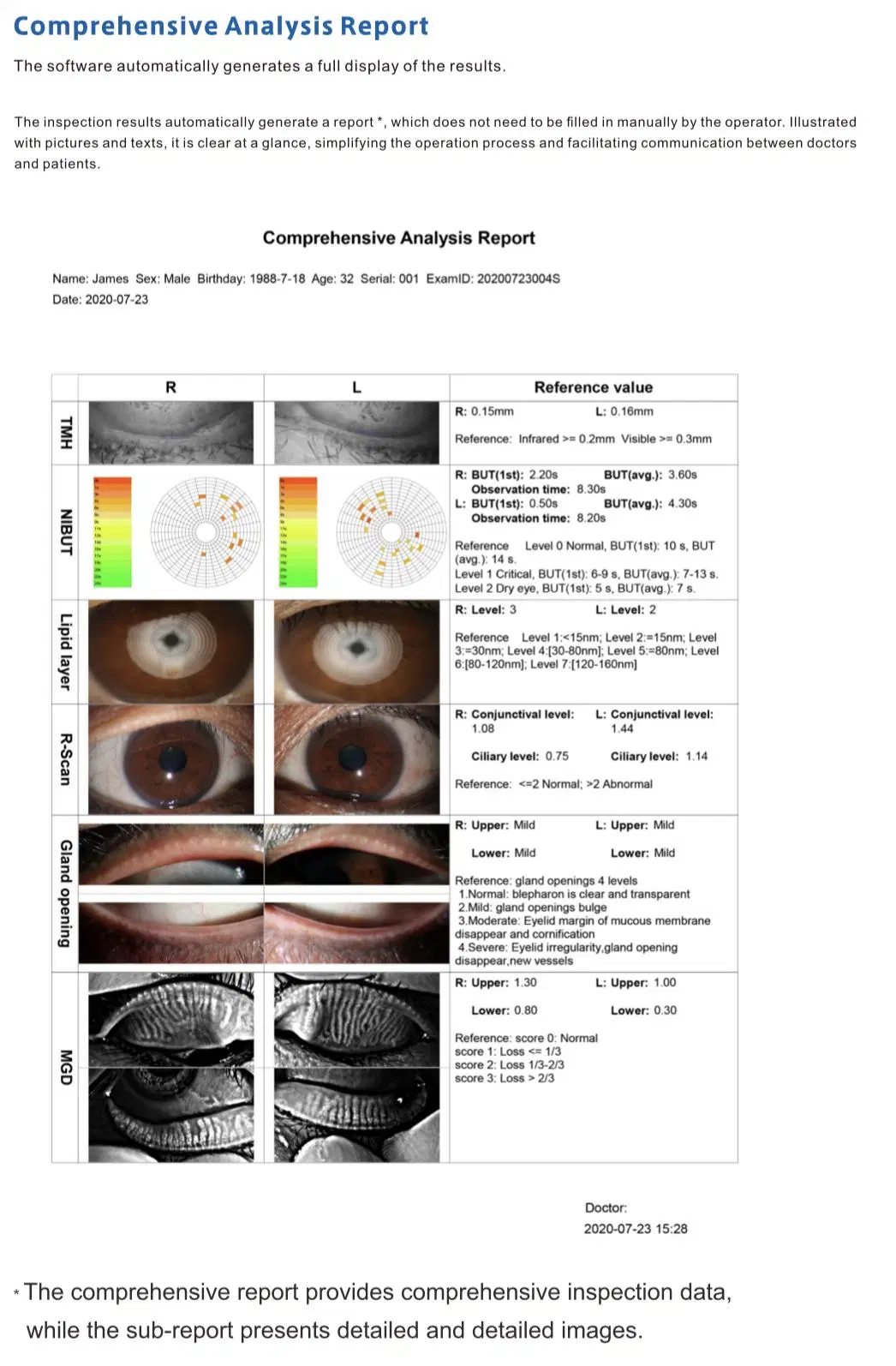 Ophthalmic Anterior Segment Dry Eye Examination Comprehensive Analyzer