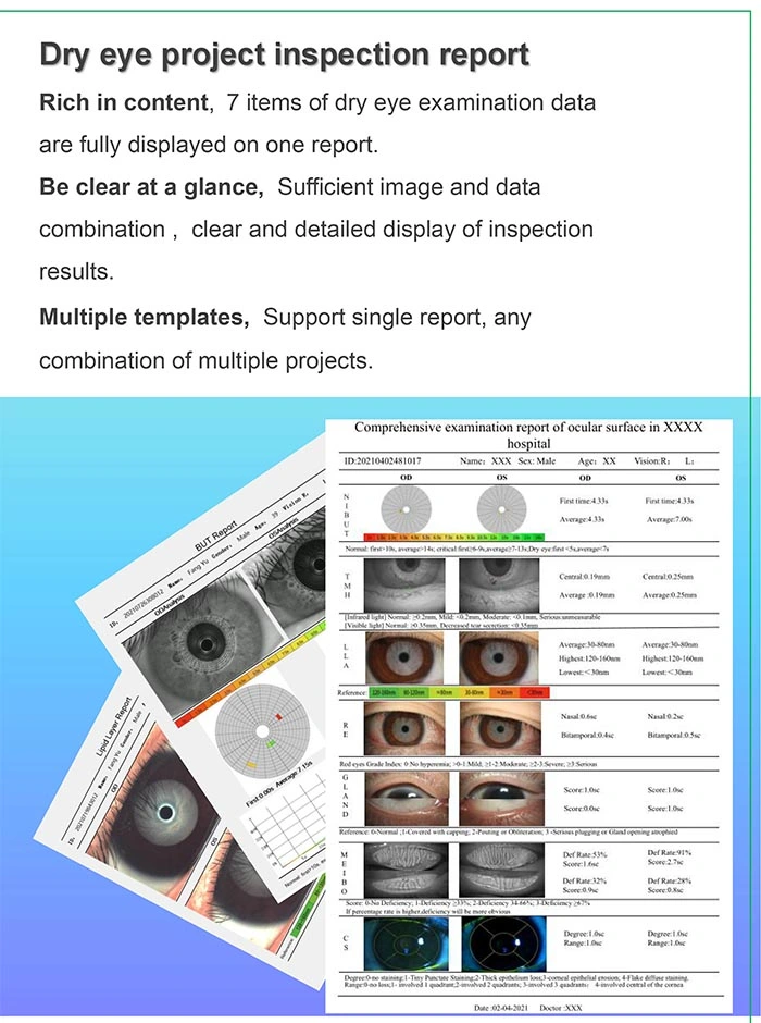 China Ophthalmic Equipment Dry Eye Examination Ocular Surface Analyzer