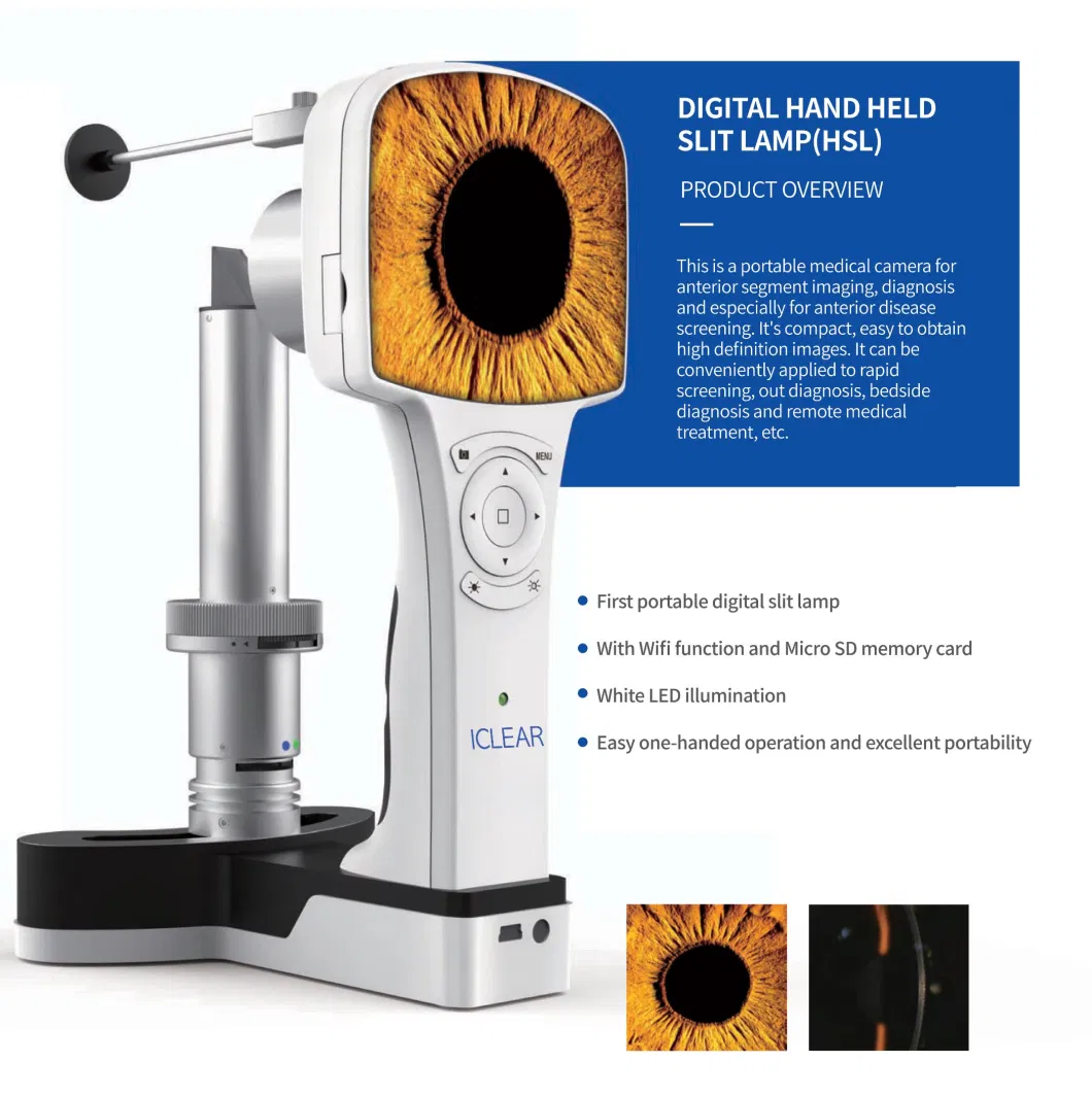 Portable Digital Anterior Segment Diagnosis Hand-Held Slit Lamp