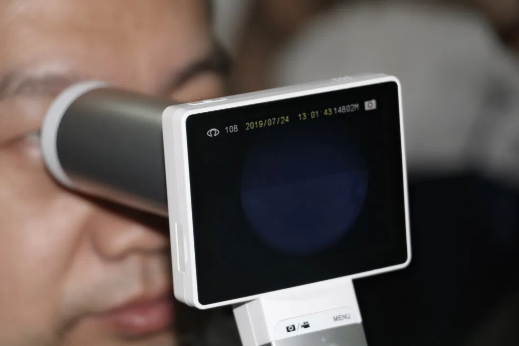 Miis Retinal Camera Horus Fundus Camera with Favorable Price