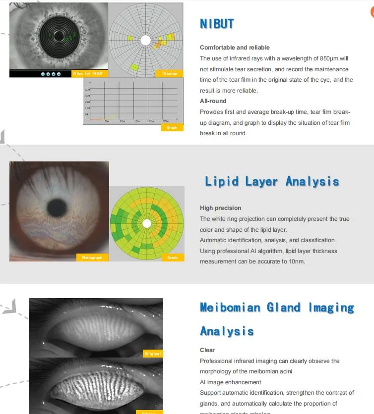 Ophthalmology Ocular Surface Analyzer Optical Instruments for Eye Hospital