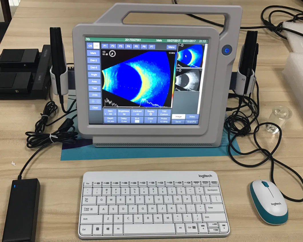 CE ISO Handheld Ophthalmic Ultrasound a/B Scan for Ophthalmological Ultrasonic Diagnosis and Al Biometric Measurement Mslmd23s