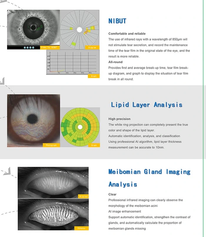 China Ophthalmic Equipment Dry Eye Examination Ocular Surface Analyzer