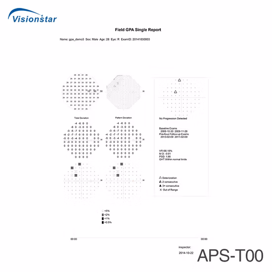High Quality CE Approved Brand New Visual Field Testing Equipment