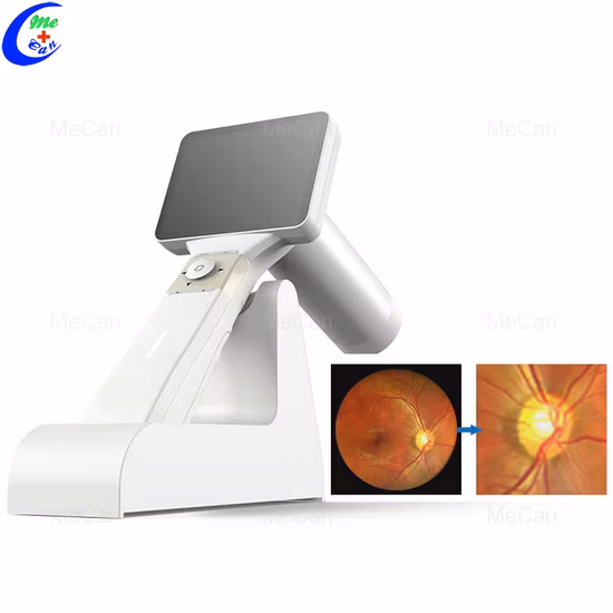 Portable Ophthalmic Fundus Camera Digital Eye Fundus Camera